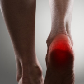 Heel Spur Surgery | Advanced Treatment for Heel Pain Relief