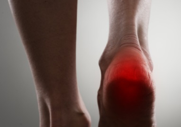 Heel Spur Surgery | Advanced Treatment for Heel Pain Relief