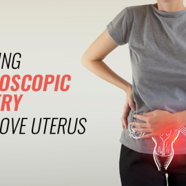 Laparoscopic surgery to remove uterus in bangalore | Worldofurology