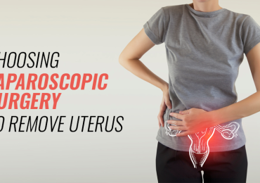 Laparoscopic surgery to remove uterus in bangalore | Worldofurology