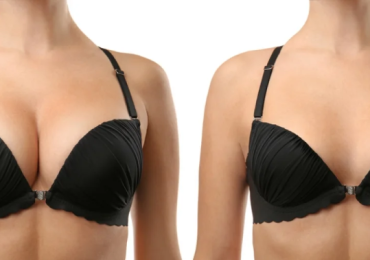 Breast Cancer Treatment Near Me – Expert Care by Dr. Shilpy Dolas with Over 5000 Successful Surgeries.