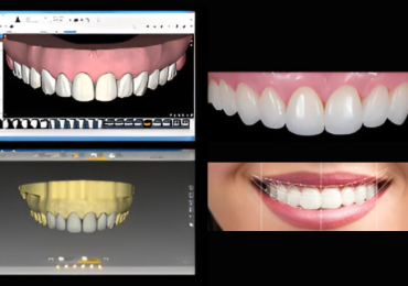 Smile Makeovers Mumbai | Expert Cosmetic Dentistry – World Dental Specialties
